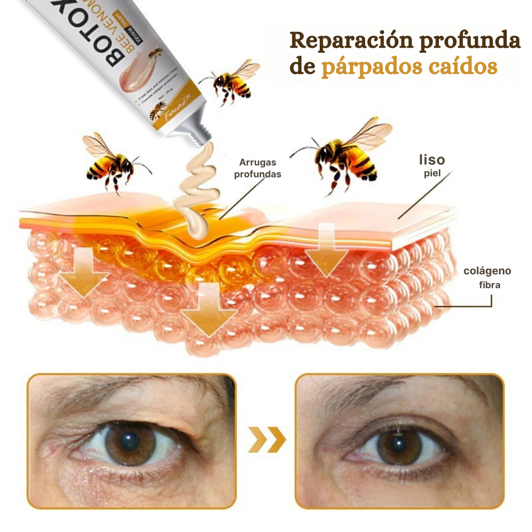 (✅Fabricado Desde Canadá👨⚕️) Crema para eliminar arrugas con veneno de abeja y botox Furzero™