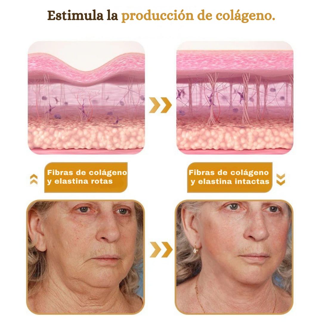 (✅Fabricado Desde Canadá👨⚕️) Crema para eliminar arrugas con veneno de abeja y botox Furzero™