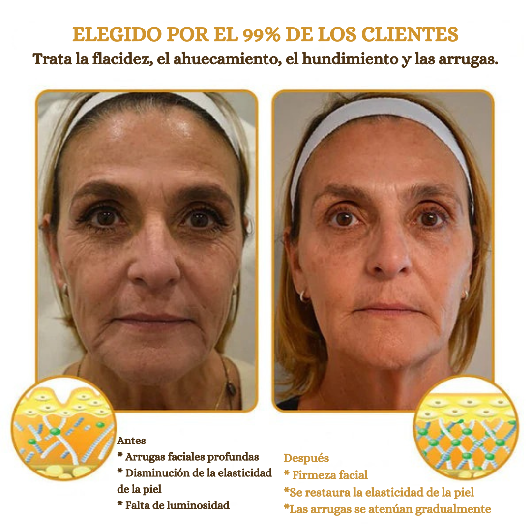 (✅Fabricado Desde Canadá👨⚕️) Crema para eliminar arrugas con veneno de abeja y botox Furzero™