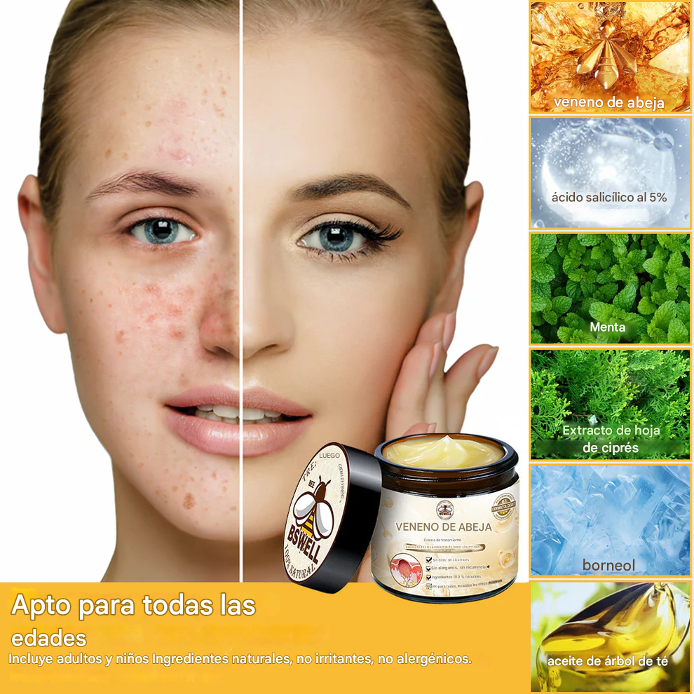 🐝✨𝑩𝑺𝑾𝑬𝑳𝑳® Crema de Veneno de Abeja 👨⚕️ (Recomendada por dermatólogos) (70% de descuento)