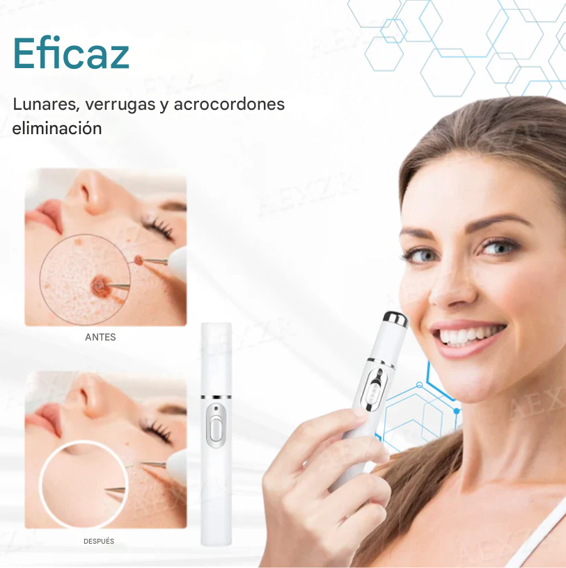 Bikenda® Láser Portátil – Elimina Verrugas,Lunares y Manchas de Forma Rápida y Sin Dolor