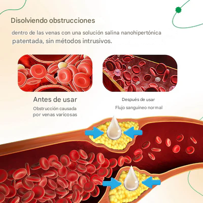 ODALIT™ - 2x1 Crema para la reducción de varices
