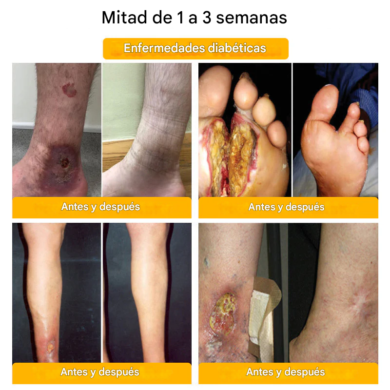 Oferta relámpago 2025🔥: Shorts moldeadores Anyidea® de fibra de titanio y turmalina de grado médico (¡Último día: 80 % de descuento! 🚨)