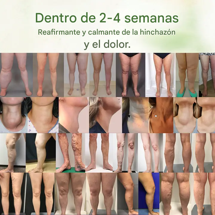 Biancat™ - Crema herbal desintoxicante linfática | ¡Alivia problemas circulatorios en 5 minutos!