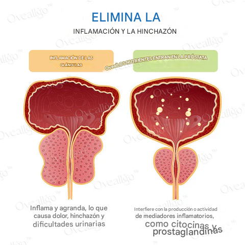 Oveallgo™ ProstaAce PT-141 Espray nasal