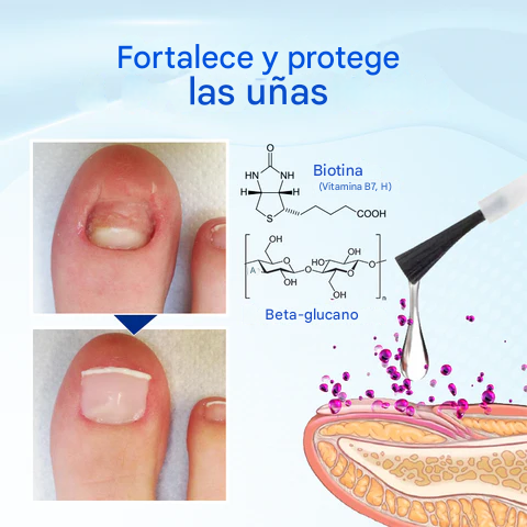 Biancat® OnyxoGuard Suero para el crecimiento y la reparación de uñas