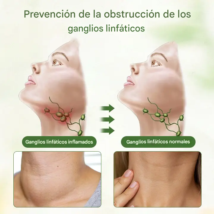 Biancat™ - Crema herbal desintoxicante linfática | ¡Alivia problemas circulatorios en 5 minutos!