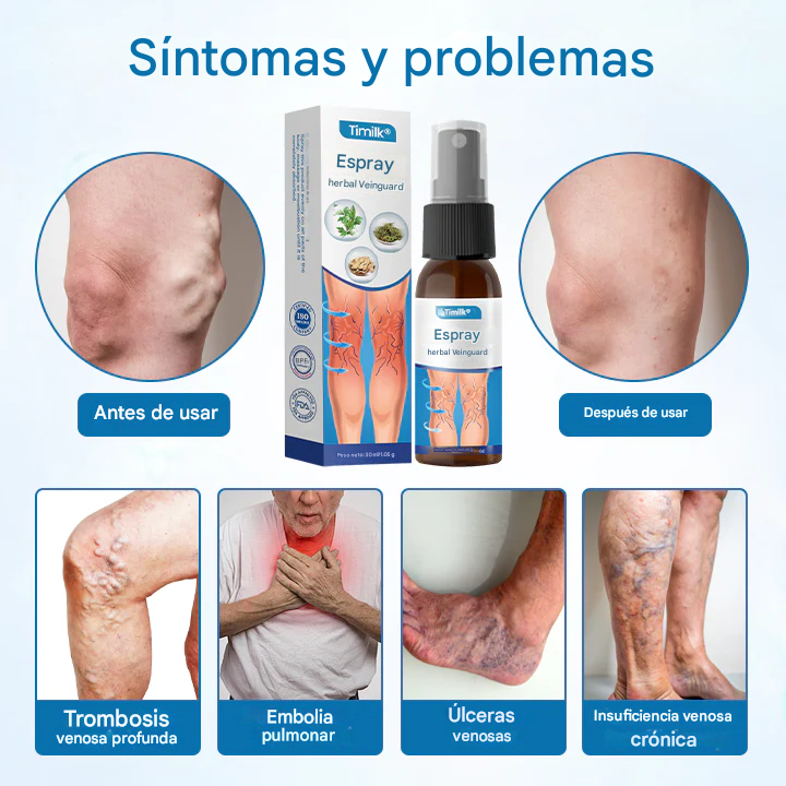 PROMO 2X1 - Timilk® - Spray Para Venas Varices