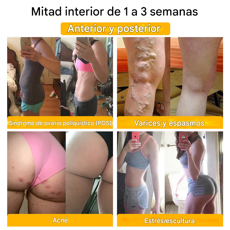 Oferta relámpago 2025🔥: Shorts moldeadores Anyidea® de fibra de titanio y turmalina de grado médico (¡Último día: 80 % de descuento! 🚨)