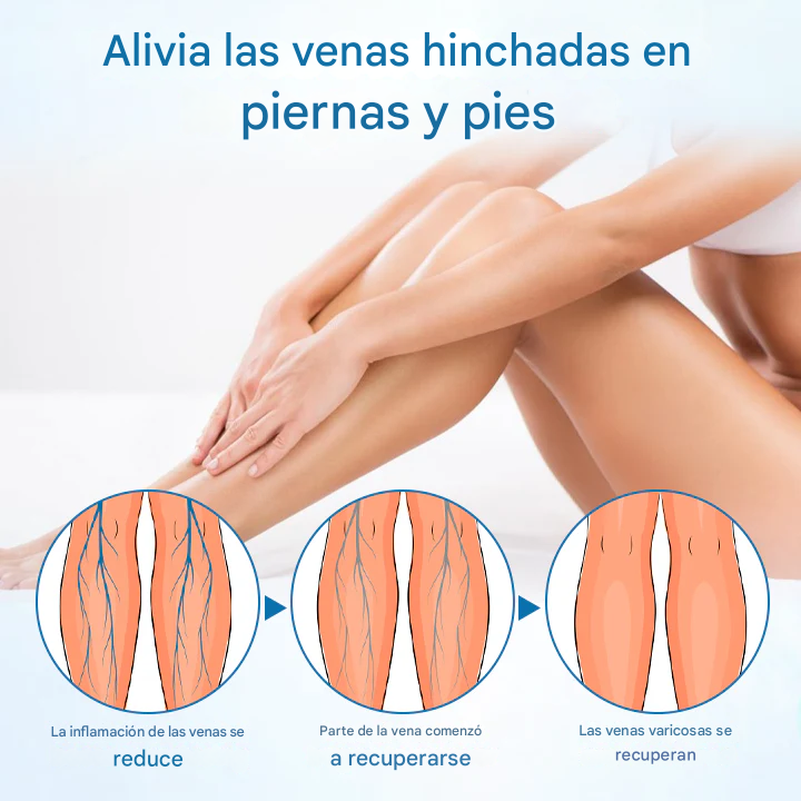 PROMO 2X1 - Timilk® - Spray Para Venas Varices