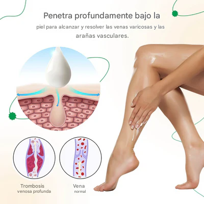 ODALIT™ - 2x1 Crema para la reducción de varices