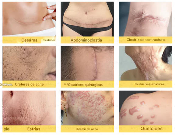 Crema reparadora rápida de 7 días para todas las enfermedades de la piel.