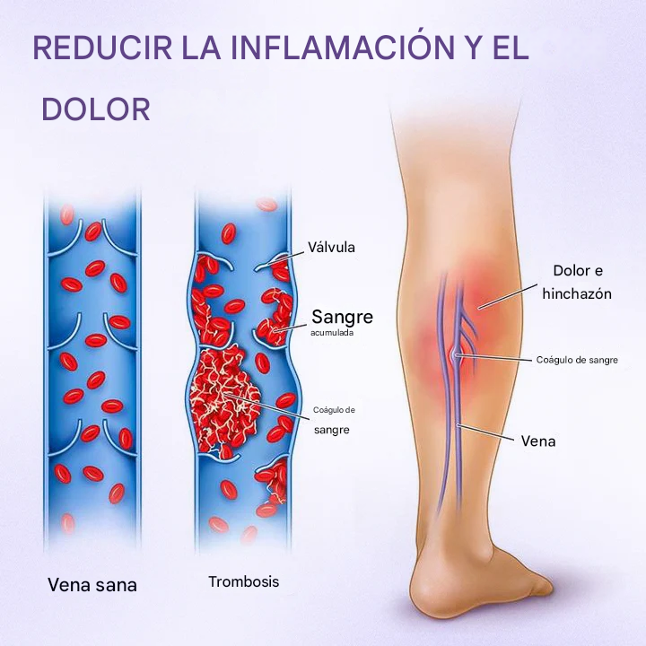 Crema fito Timilk® VeinRelief