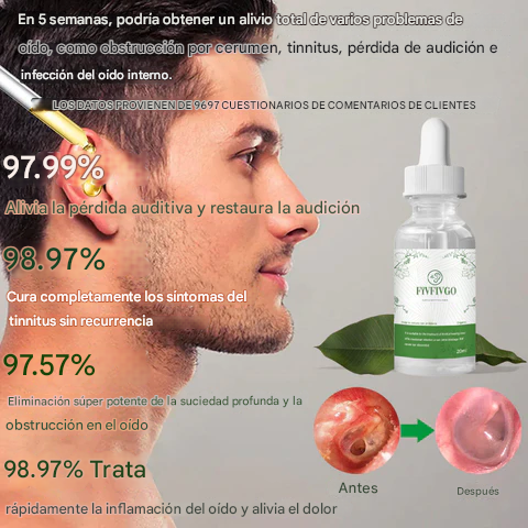 Gotas herbales orgánicas Fivfivgo™ para el tinnitus
