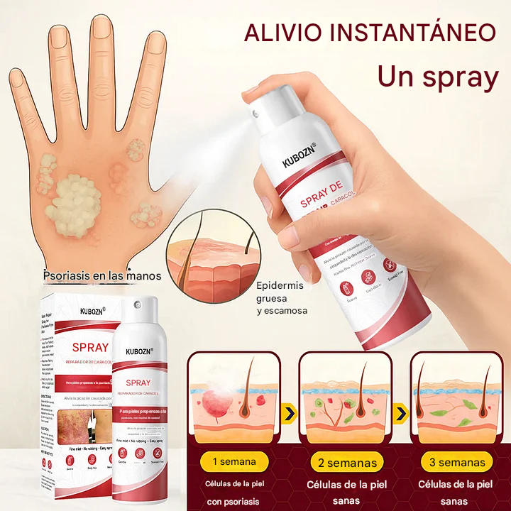 KUBOZN® Spray reparador de caracol para piel con psoriasis, con picazón y descamación.