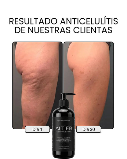 DERMODELUXE – Emulsión Corporal Anticelulitis, Antiflacidez y Efecto Drenante