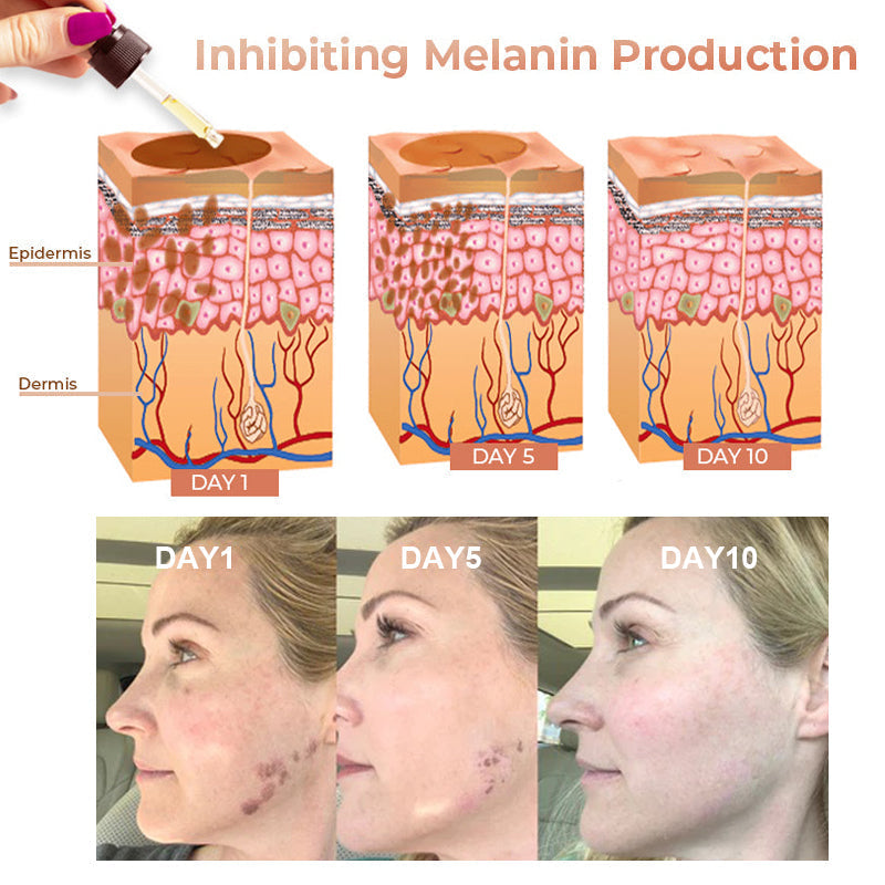 Eliminador rápido de manchas oscuras: suero facial corrector de melanina NESLEMY™