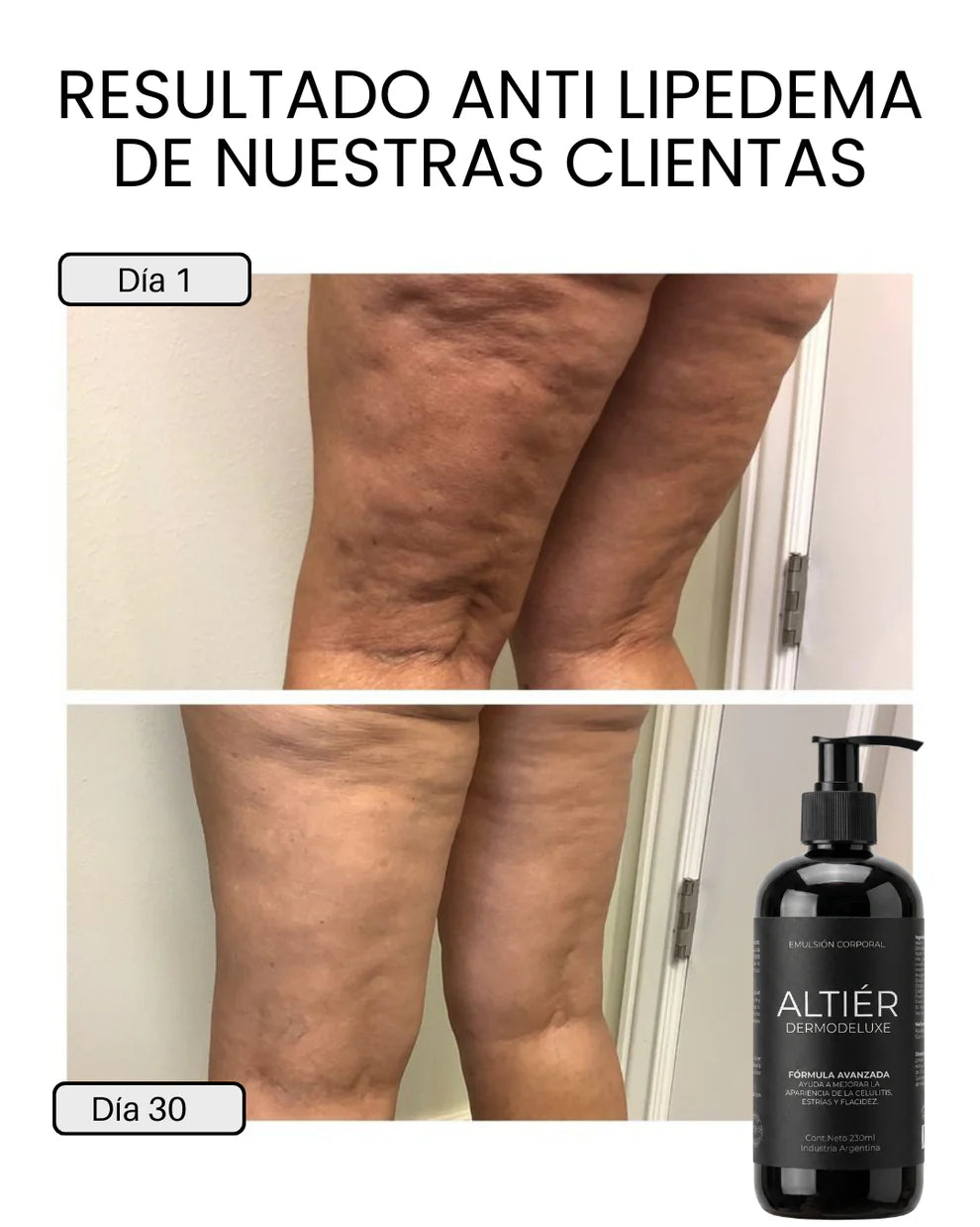 DERMODELUXE – Emulsión Corporal Anticelulitis, Antiflacidez y Efecto Drenante