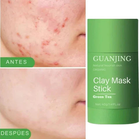 Promo 2x1 - Mascarilla Anti Acné té verde 100% orgánico