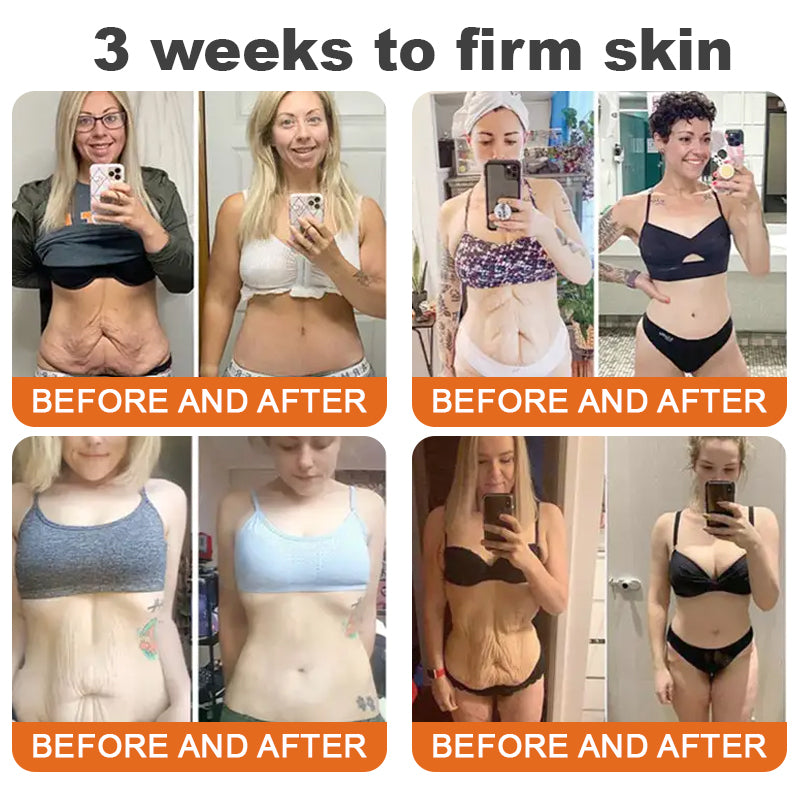 TLOPA® Botox Sérum reafirmante en barra con veneno de abeja (🔥ÚLTIMO DÍA 70% DE DESCUENTO)