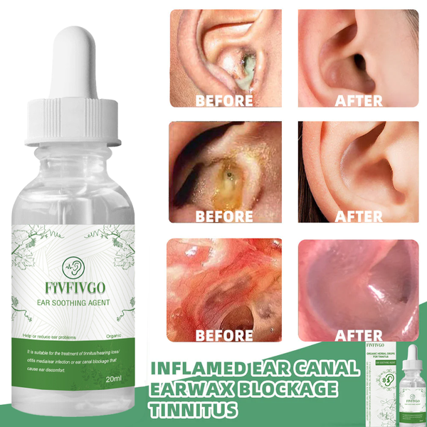 Gotas herbales orgánicas Fivfivgo™ para el tinnitus