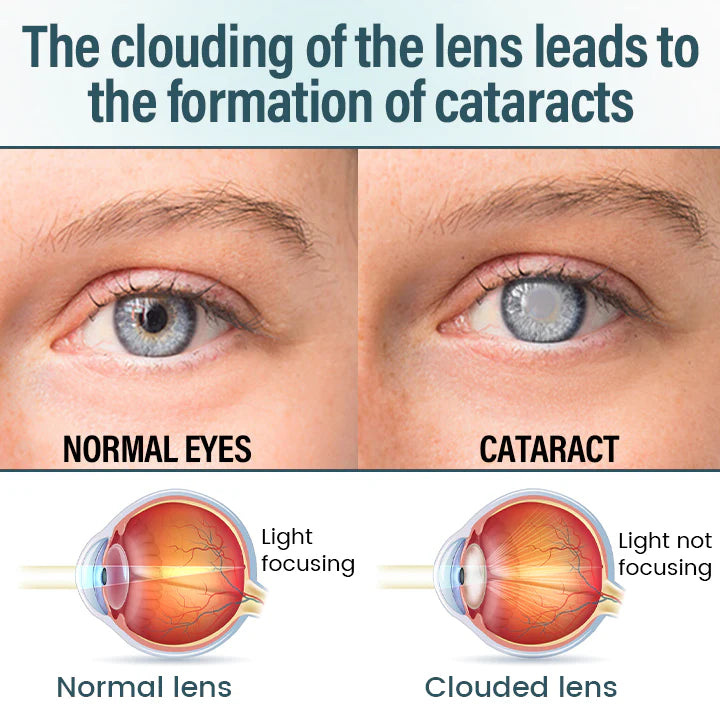 Suero para gotas oftálmicas Timilk® OptiFusion Nano