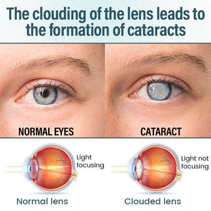 Suero para gotas oftálmicas Timilk® OptiFusion Nano