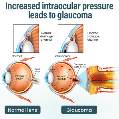 Suero para gotas oftálmicas Timilk® OptiFusion Nano