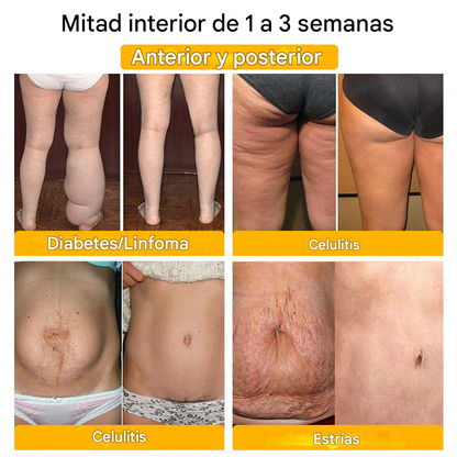 Oferta relámpago 2025🔥: Shorts moldeadores Anyidea® de fibra de titanio y turmalina de grado médico (¡Último día: 80 % de descuento! 🚨)