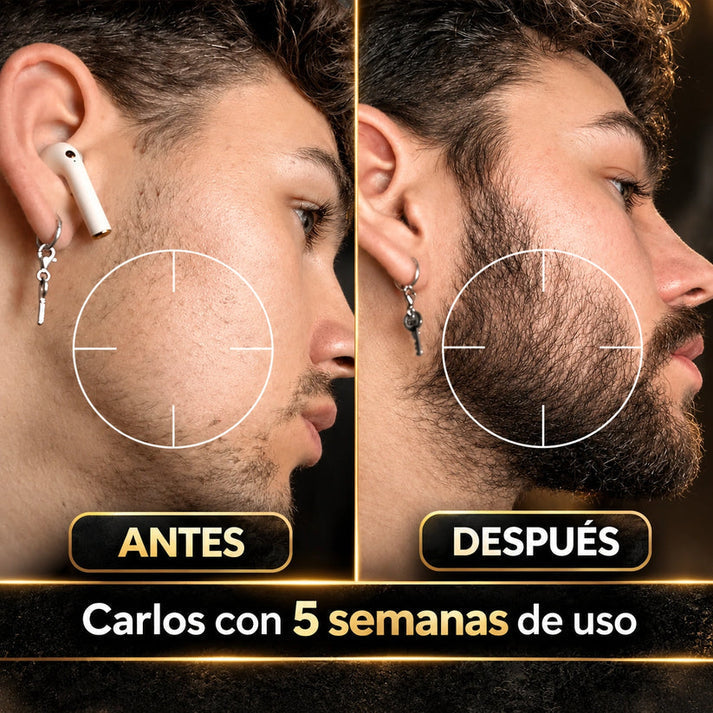🧔🏻Bálsamo Estimulante De Barba Apolo + Activador : Barba más densa, fuerte y saludable🧴