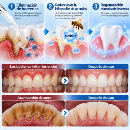 PerioCore - Suero periodontal con veneno de abeja