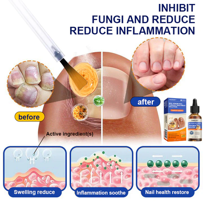 PROMO 2X1 Solución para el tratamiento de hongos en las uñas con veneno de abeja