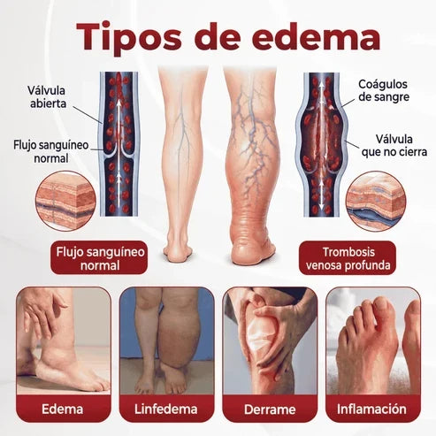 SwellVeil - Crema para la circulación de piernas