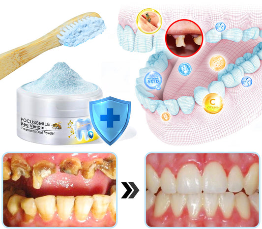 Polvo oral para tratamiento con veneno de abeja Furzero™ Focussmile 🦷