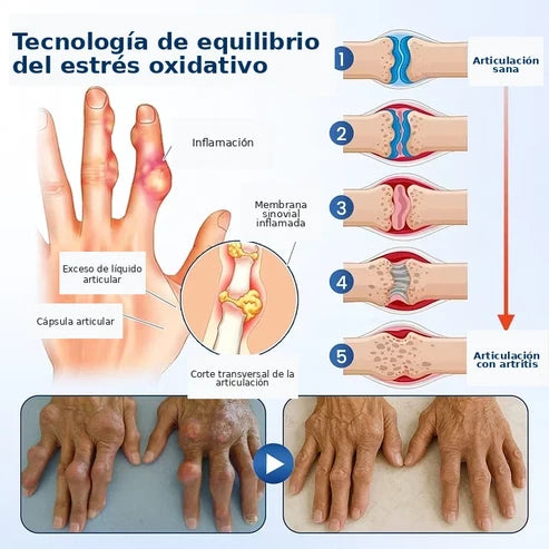 Crema ArthriNAD+ Pro para la recuperación avanzada de las articulaciones