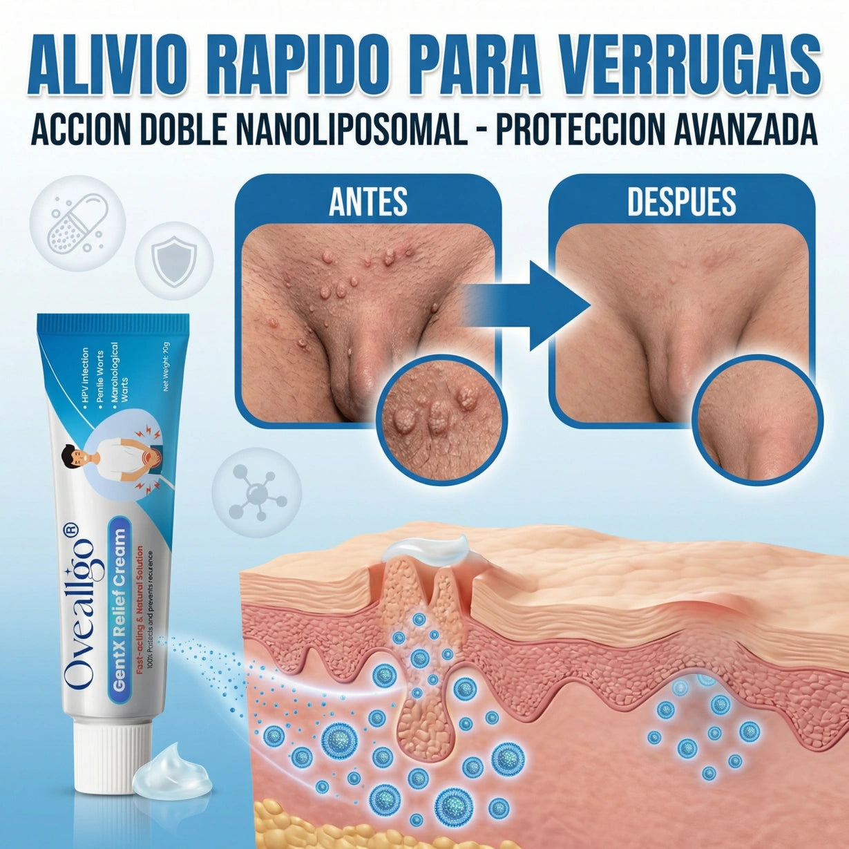 Oveallgo® – Crema para el alivio de las verrugas íntimas VPH - Ideal para hombres y mujeres + 🎁🎁.