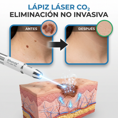 Bikenda® Láser Portátil – Elimina Verrugas,Lunares y Manchas de Forma Rápida y Sin Dolor + 🎁.