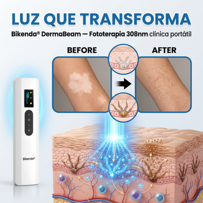 Dispositivo de terapia para el vitíligo Bikenda® DermaBeam