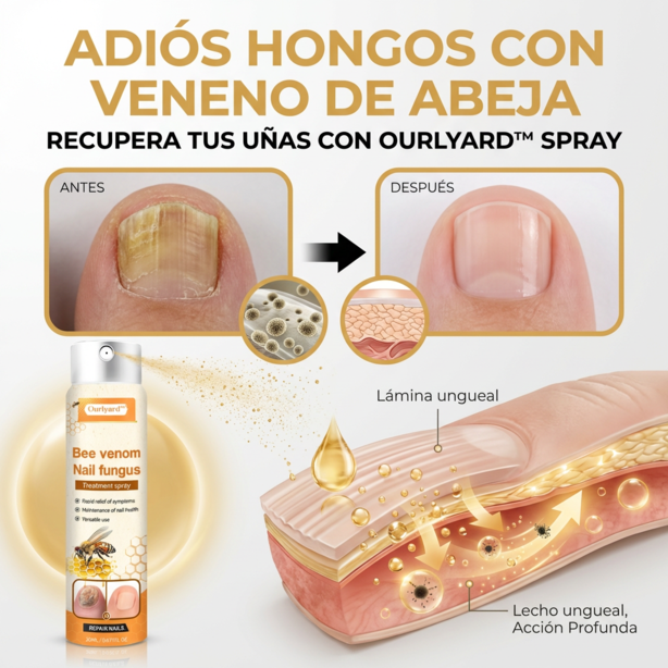 Paga 1 lleva 2 Bee Venom - Nail Fungus Spray Natural