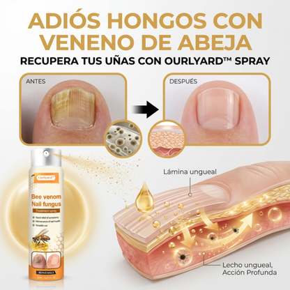 Paga 1 lleva 2 Bee Venom - Nail Fungus Spray Natural