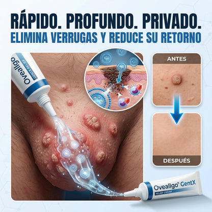 Oveallgo® – Crema para el alivio de las verrugas íntimas VPH - Ideal para hombres y mujeres + 🎁🎁.