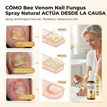 Paga 1 lleva 2 Bee Venom - Nail Fungus Spray Natural