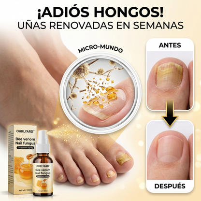 Paga 1 lleva 2 Bee Venom - Nail Fungus Spray Natural