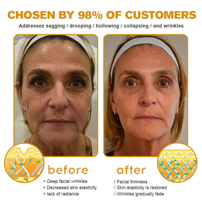 (✅Fabricado Desde Canadá👨‍⚕️) Crema para eliminar arrugas con veneno de abeja y botox Furzero™