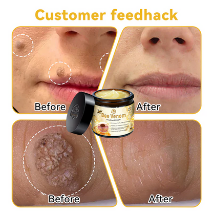 PROMO 2X1 - ✨🐝Crema para el tratamiento de la piel con veneno de abeja Turonu™ (aprobada por Health Canada✅)