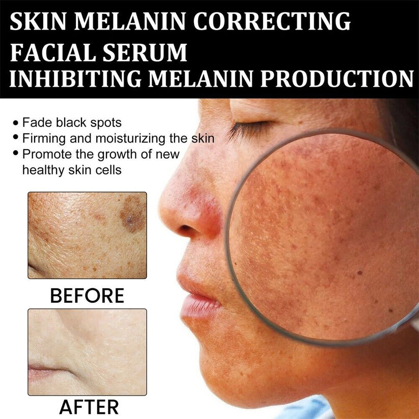 Eliminador rápido de manchas oscuras: suero facial corrector de melanina NESLEMY™