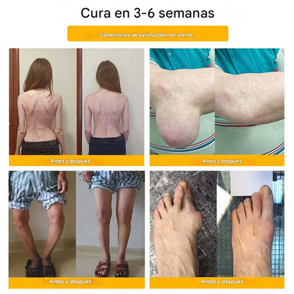 ADFIRE® Espray para la curación de huesos con veneno de abeja para aliviar el dolor