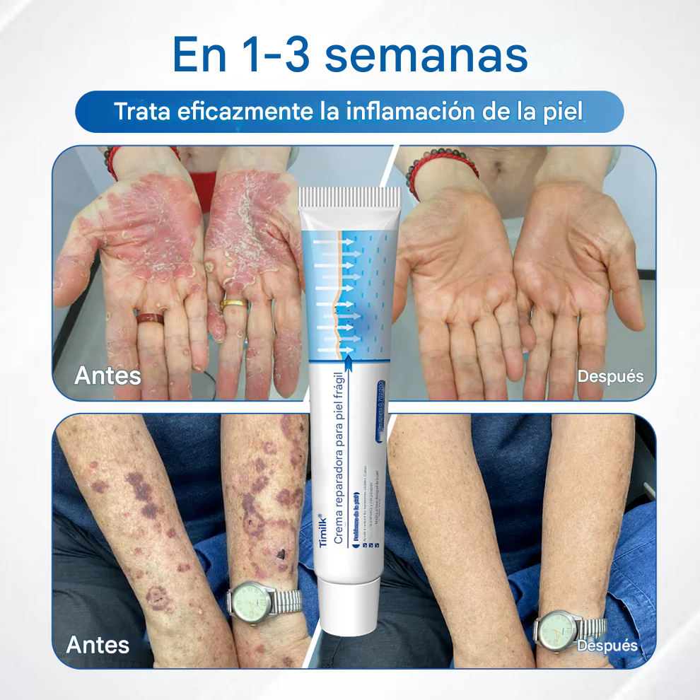 Crema reparadora para pieles frágiles 🛡️🌿 Multireparación para hematomas, sequedad y manchas