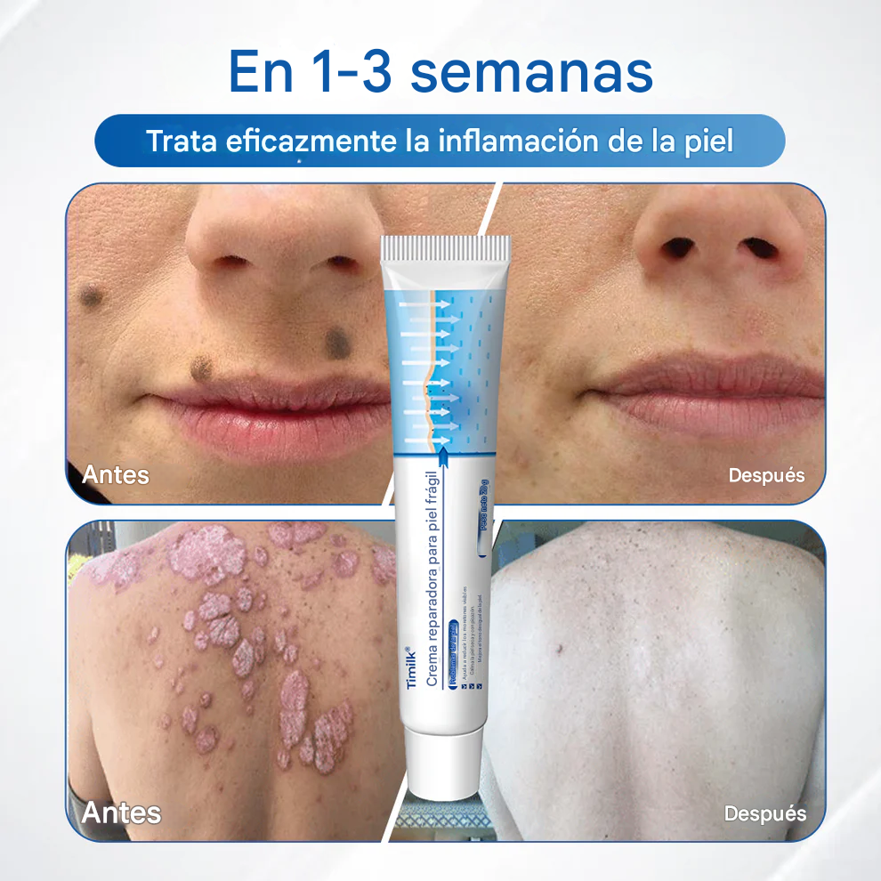 Crema reparadora para pieles frágiles 🛡️🌿 Multireparación para hematomas, sequedad y manchas