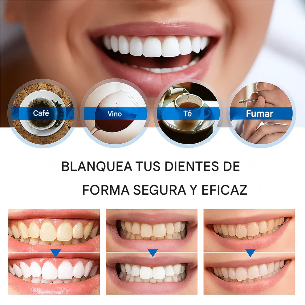 Lápiz blanqueador dental Instant Bright – Suave y sin sensibilidad